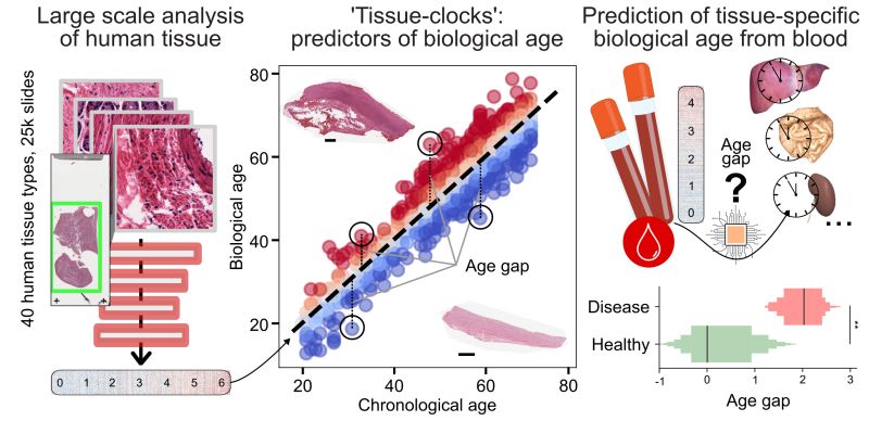 #aging #computationalpathology #digitalpathology #deeplearning #biomarkers | AndrÃ© Rendeiro | 31 comments